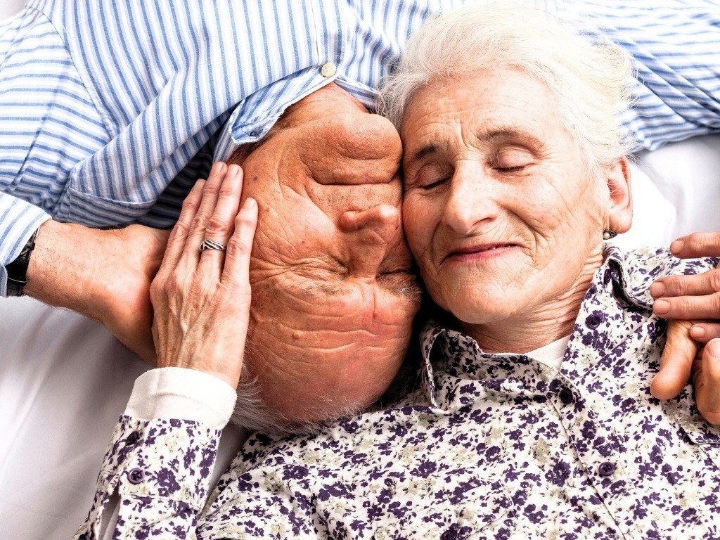 Alzheimer is Hersendiabetes type 3